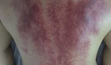 怎么刮痧背部视频教程,轻松掌握背部刮痧技巧